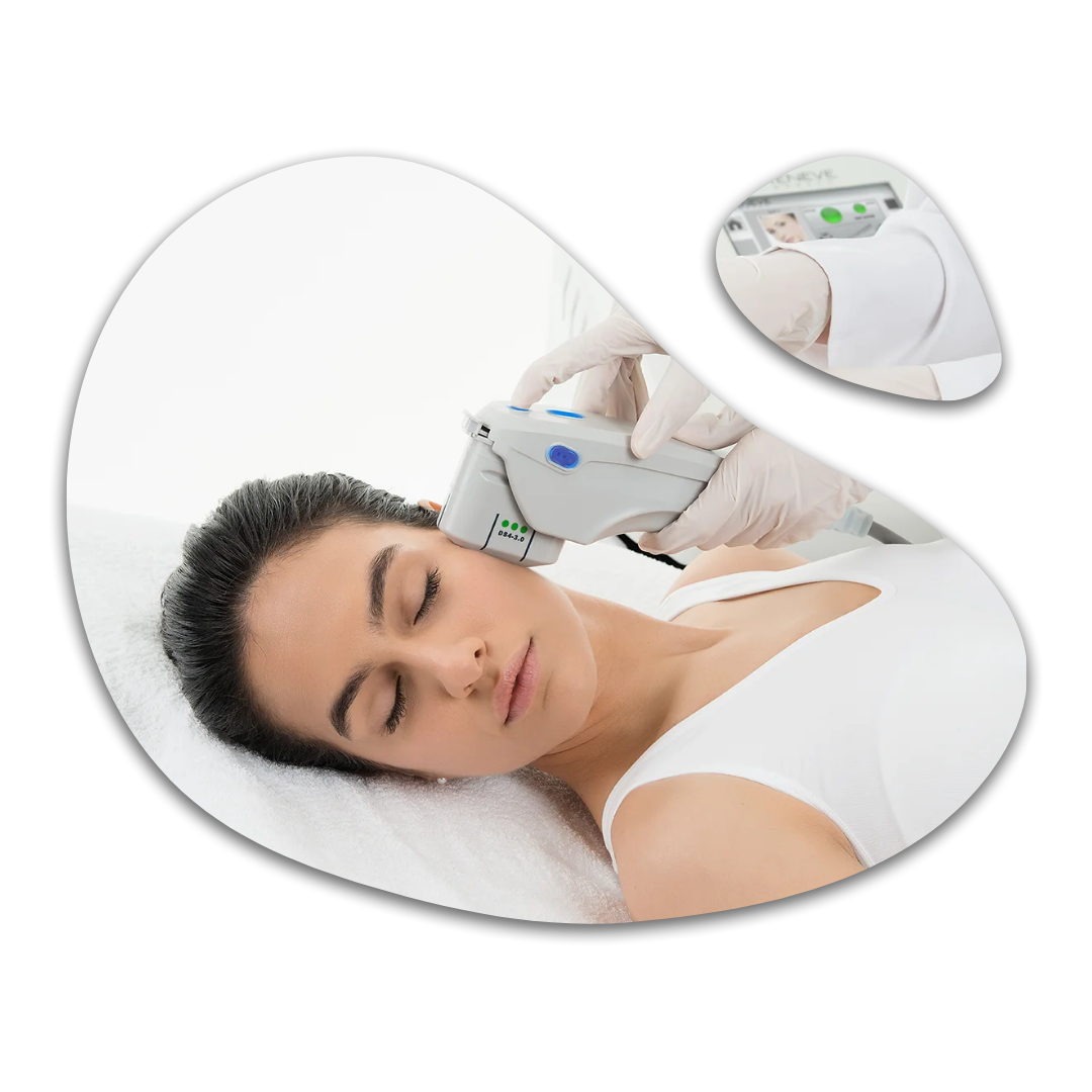 Revitex hifu casablanca