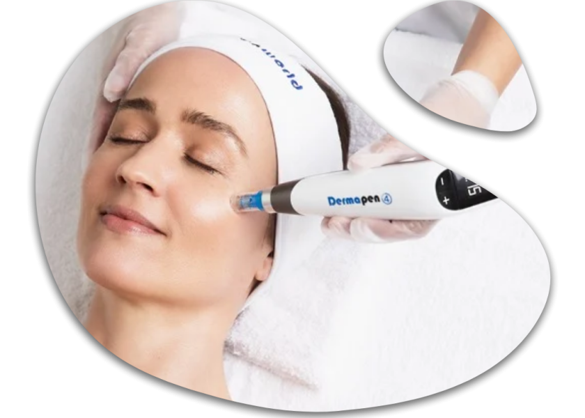 Microneedling Dermapen casablanca