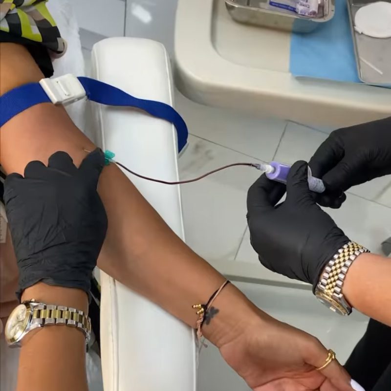 Injections esthétiques Casablanca prp casablanca Meclinic casablanca
