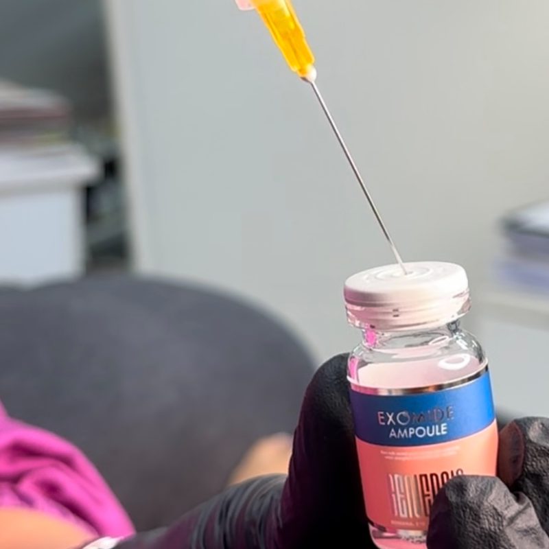 Injections esthétiques Casablanca exomide casablanca Meclinic casablanca