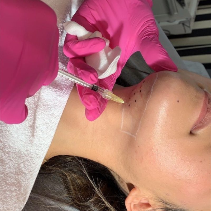 Injections esthétiques Casablanca pb serum casablanca Meclinic casablanca