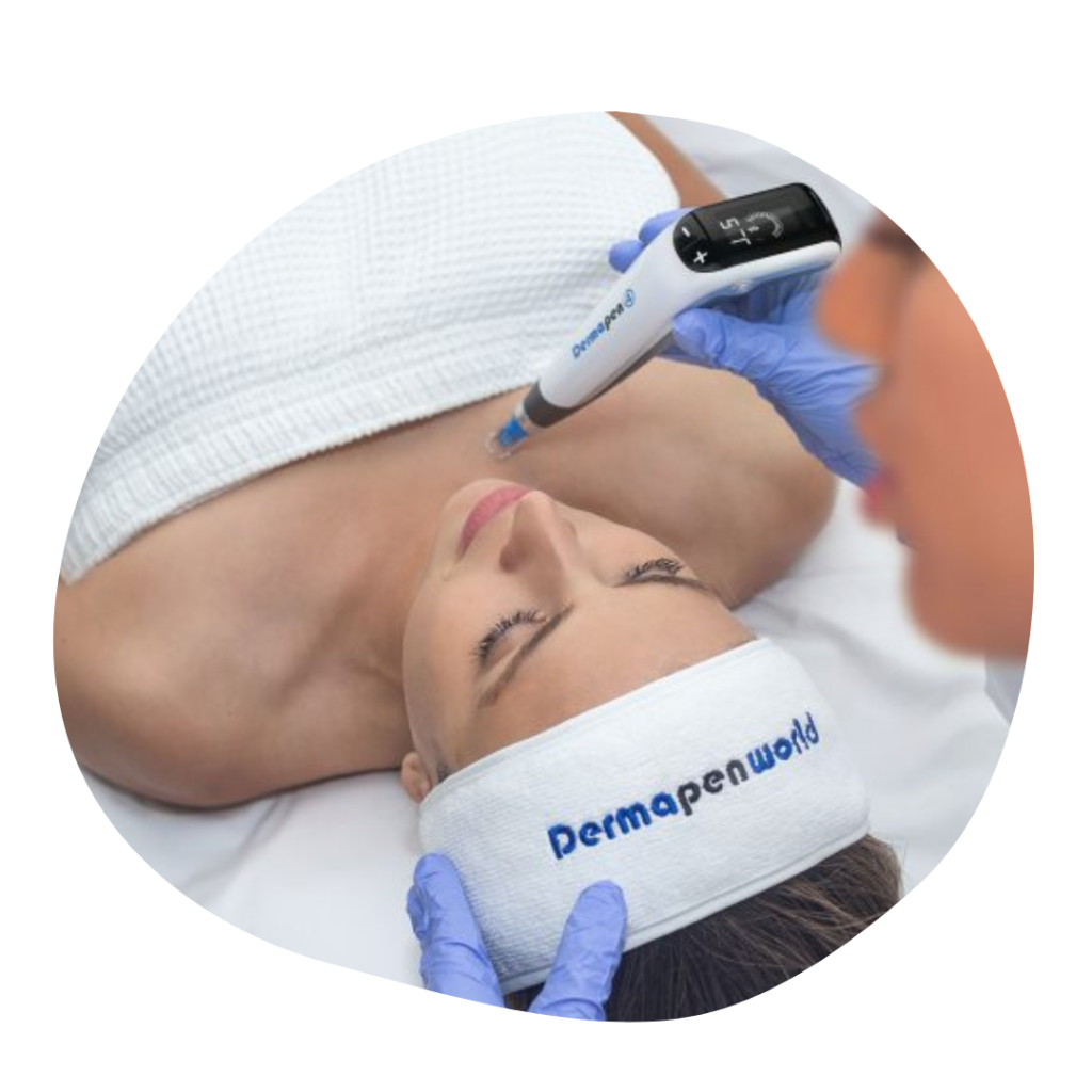 Microneedling Casablanca