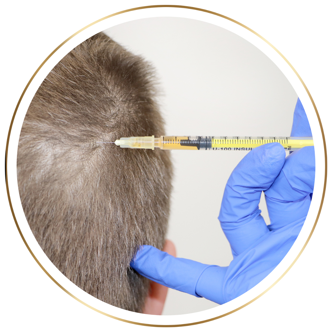 Injections esthétiques Casablanca prp casablanca biofiller casablanca Vampirelift Casablanca