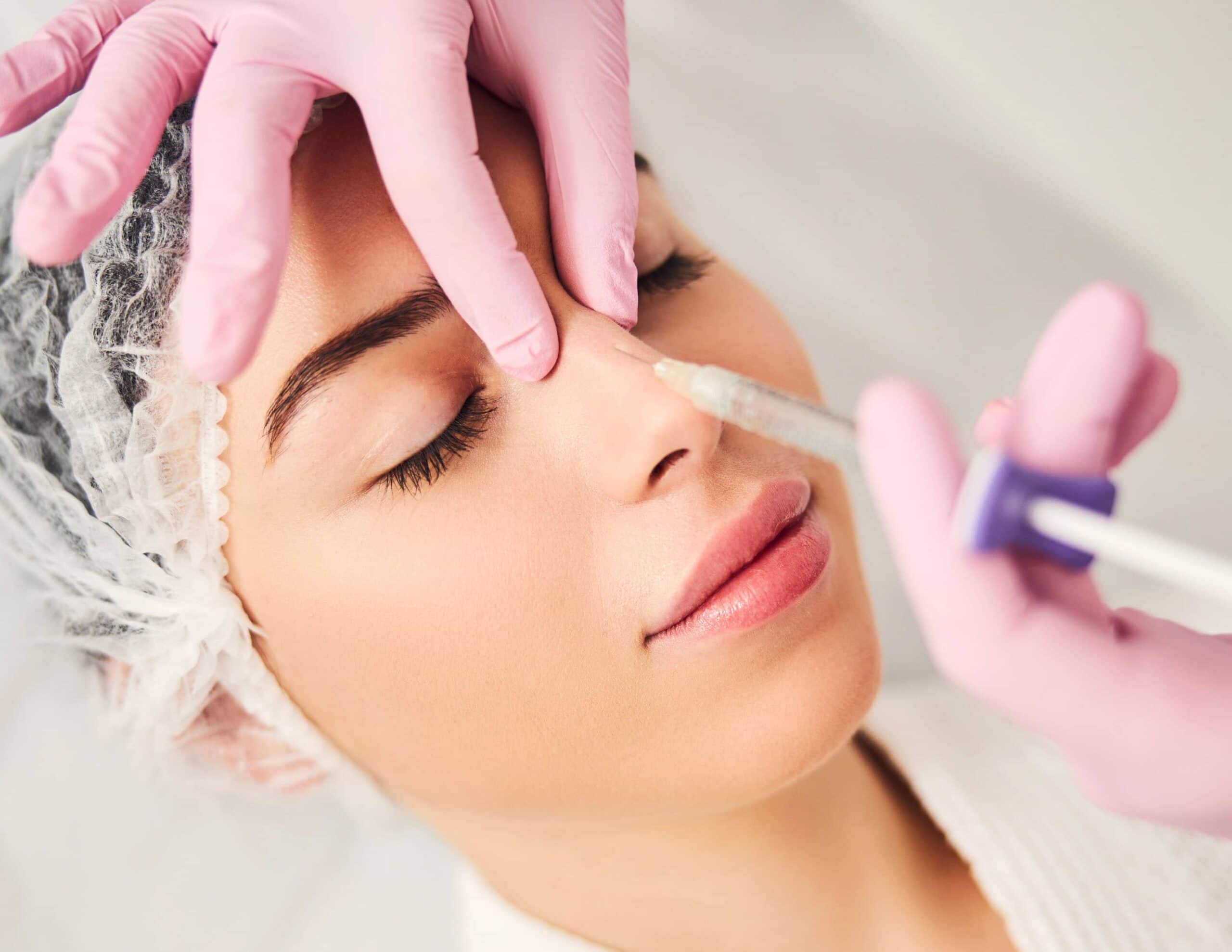 Rhinoplastie Médicale : Acide Hyaluronique Nez