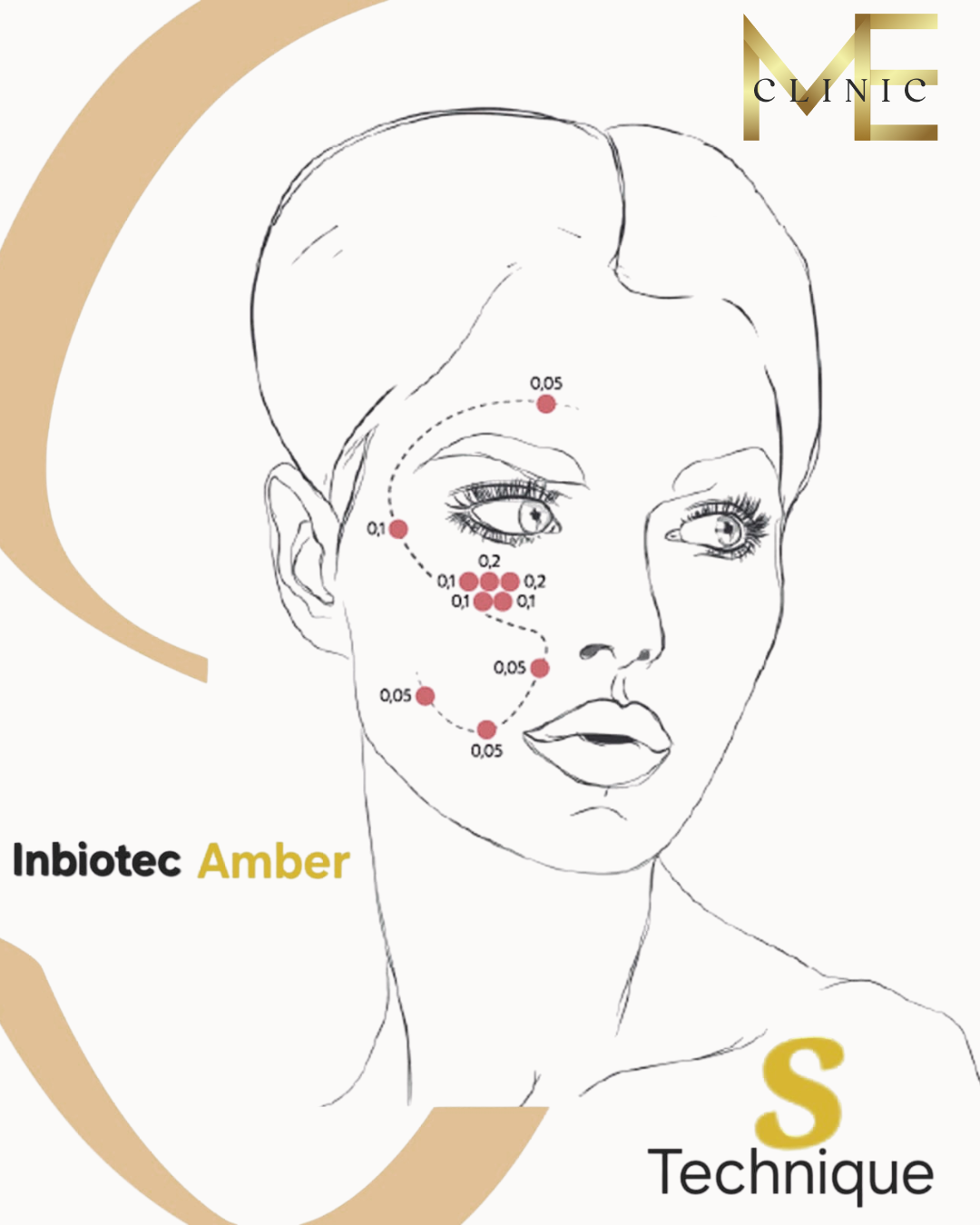 Injection Ambre Casablanca
