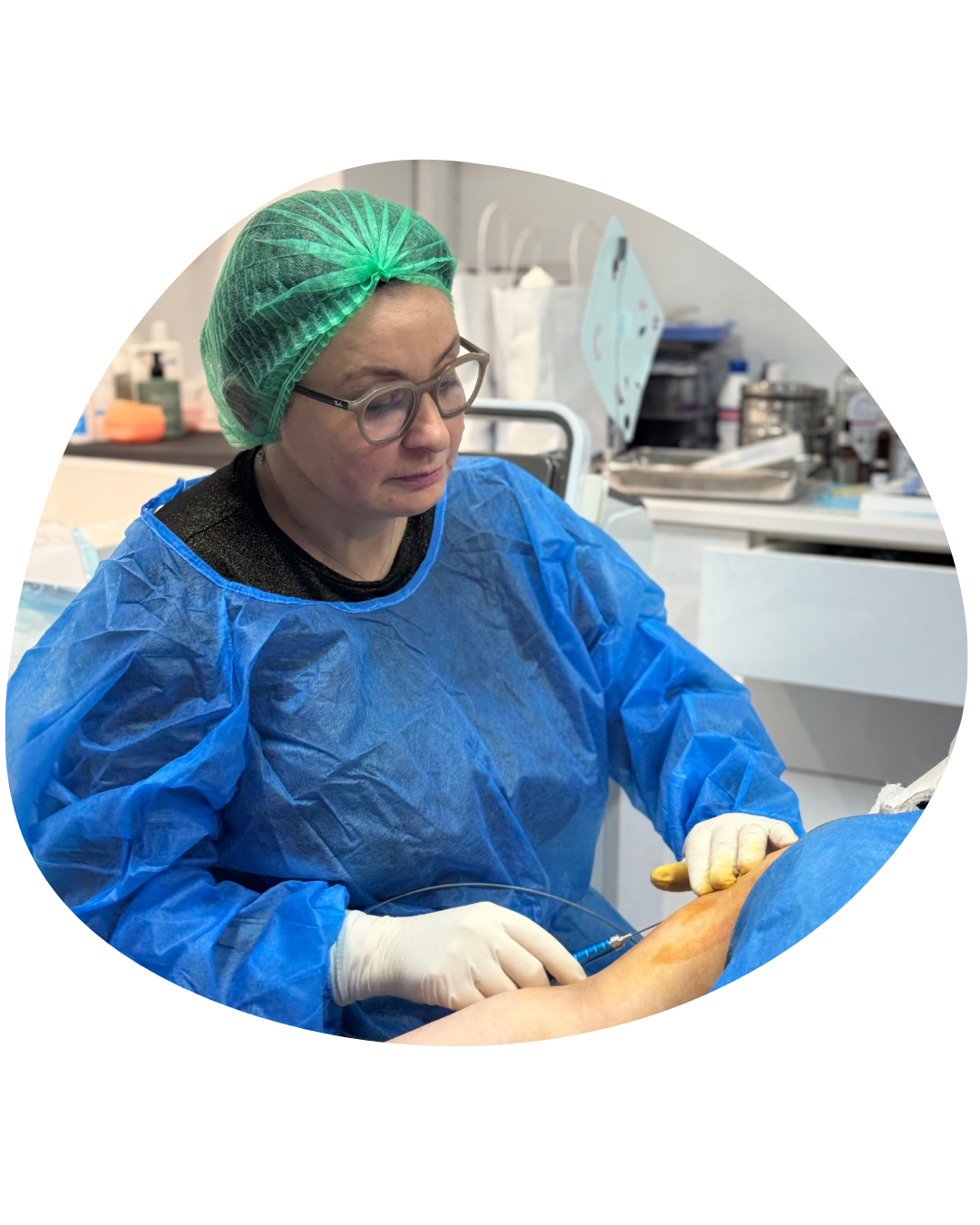 Melinic EndoLift à Casablanca : Lifting Sans Chirurgie